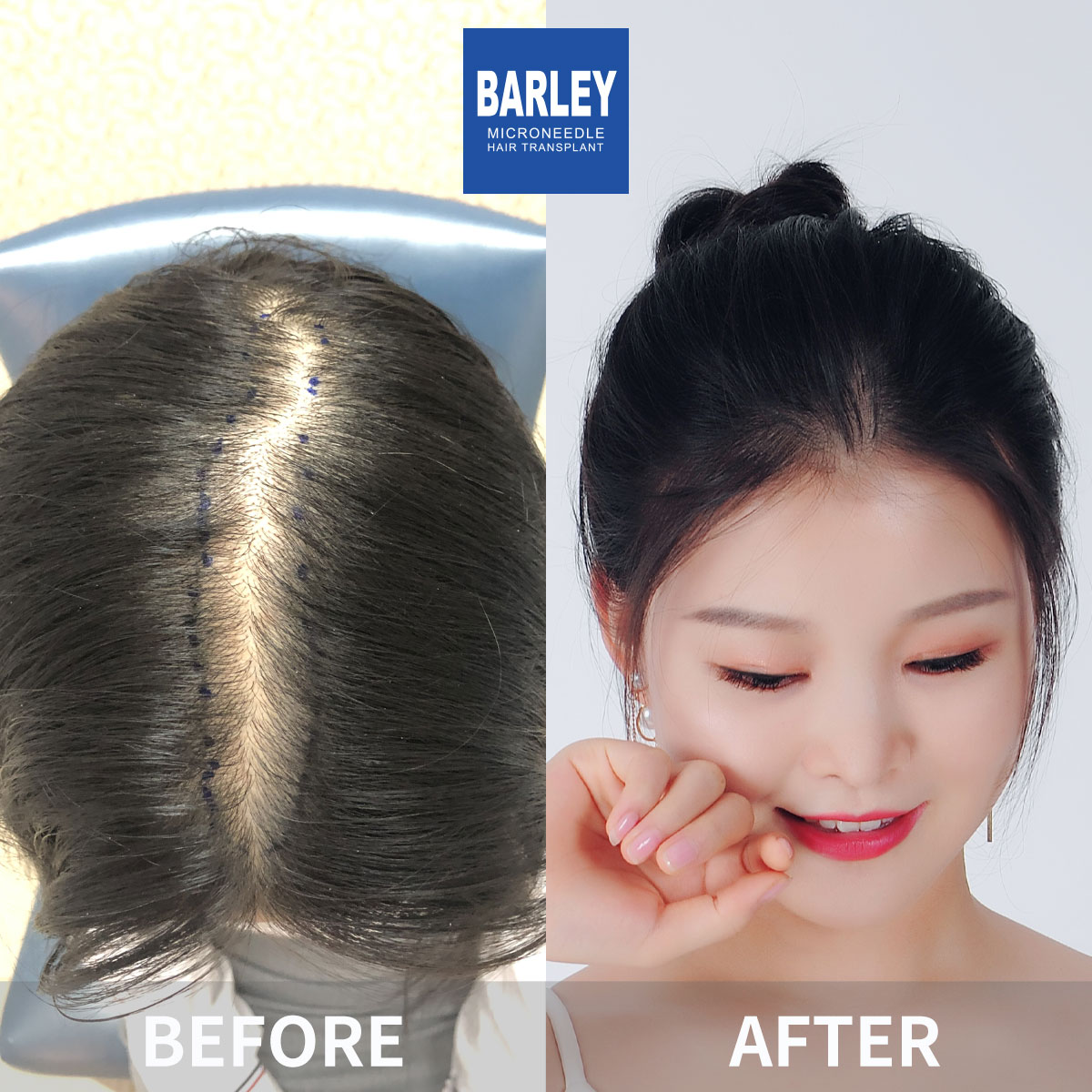 女性毛髮修復