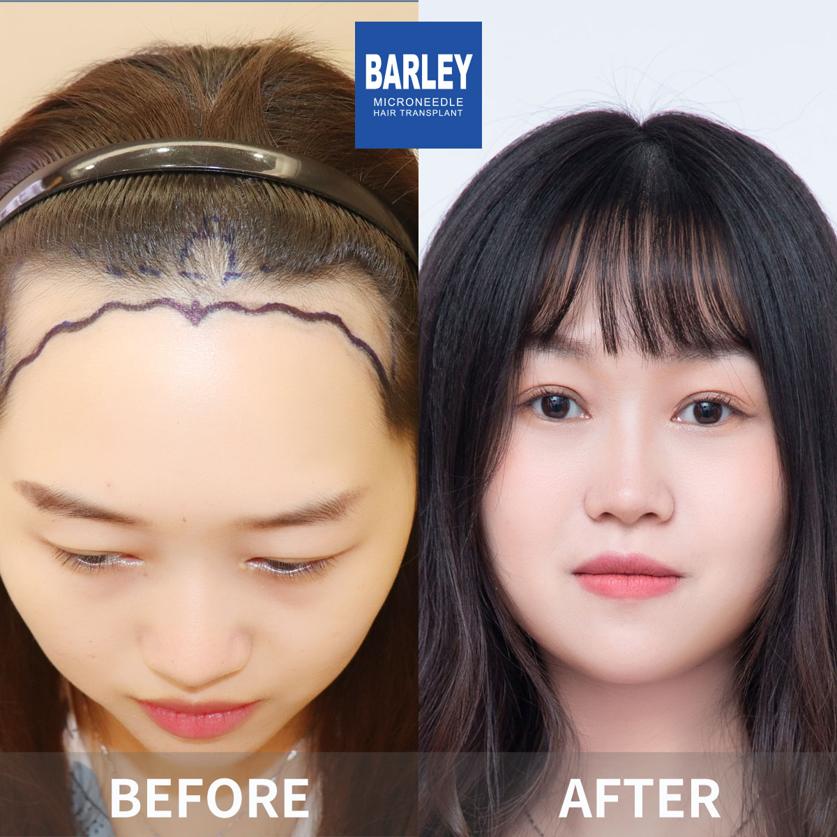 女性頭髮加密